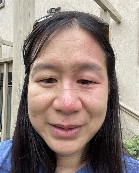 Pepper Spray Side Effects at Melissa Wolf blog