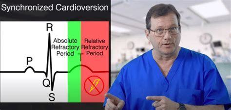 Image result for Synchronized Cardioversion Where It Fire