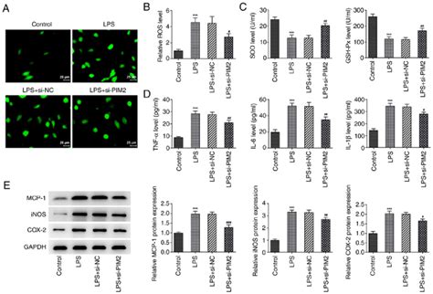 Image result for PIM2 Intracellular