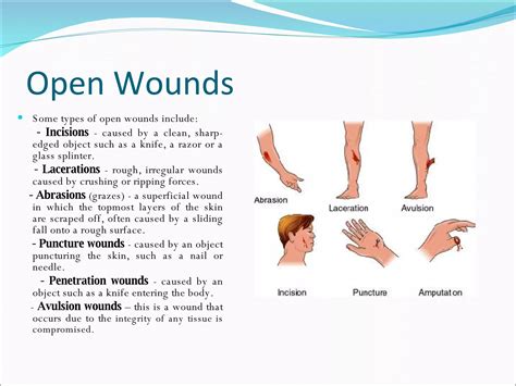 Wounds | PPT