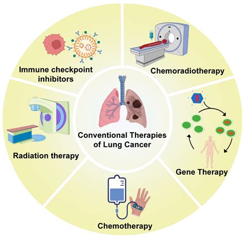 Nanoparticles in Lung Cancer Treatment | Encyclopedia MDPI