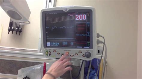 Image result for Synchronized Cardioversion SVT