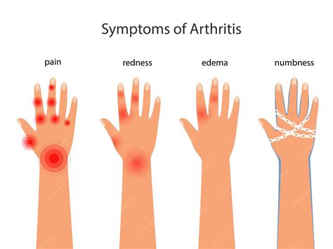 Premium Vector | Symptoms of rheumatoid arthritis redness edema numbness pain in the hands with ...