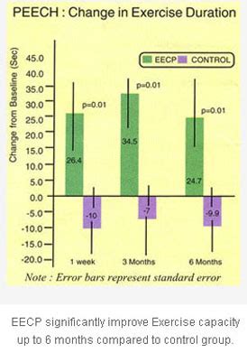 EECP Treatment Doctors Guide | EECP Therapy Procedure