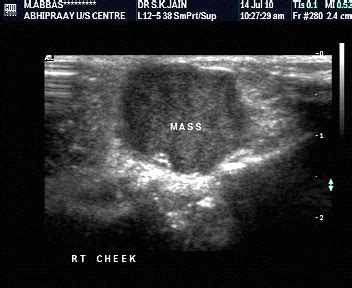 Know the Basics Of Musculoskeletal Ultrasound
