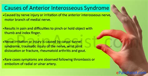 Anterior Interosseous Syndrome: Signs, Treatment, Causes, Diagnosis