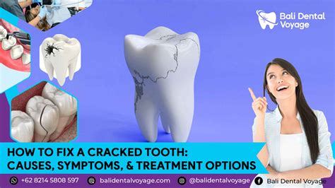 How To Keep Cracked Tooth Clean at Matthew Greig blog