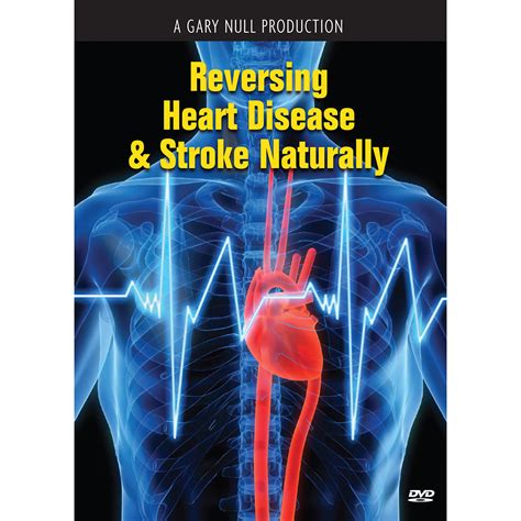 Reversing Heart Disease & Stroke Naturally DVD – Gary's Vitamin Closet