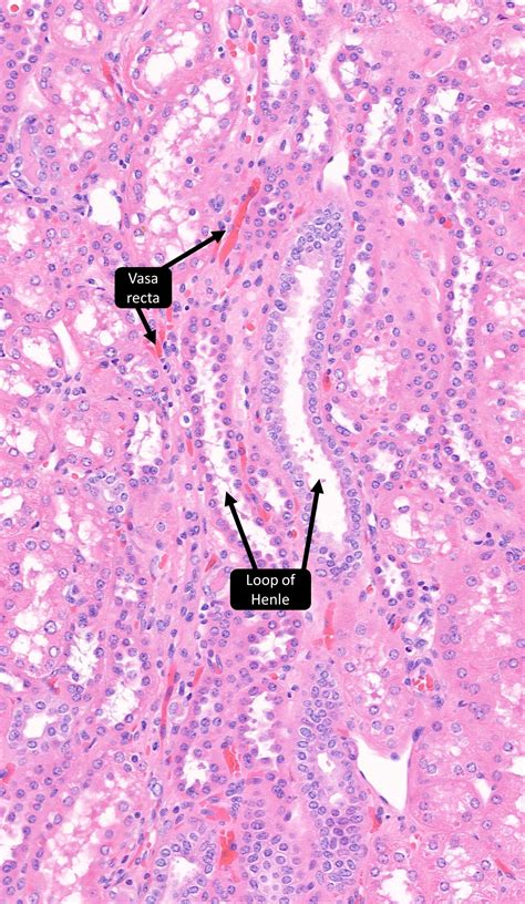 Loop Of Henle Histology Histology Slides 1