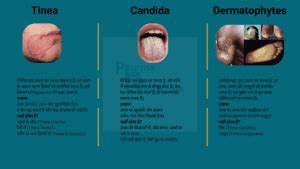 कैंडिड बी क्रीम के फायदे: उपयोग, साइड इफेक्ट्स और सावधानियां ...