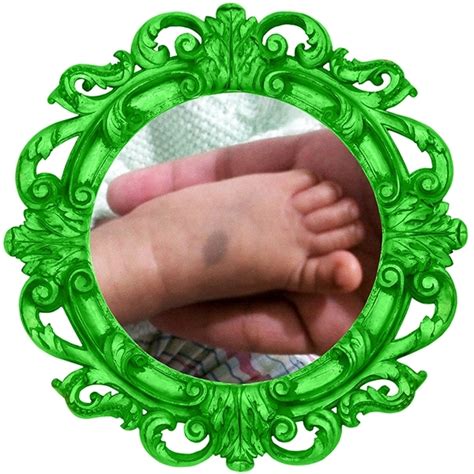 Mancha azul o mongólica en recién nacidos (Fotos) | BabyCenter