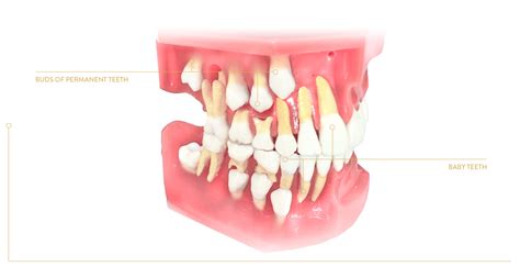 Paediatric dentistry Krakow Poland - Cichoń