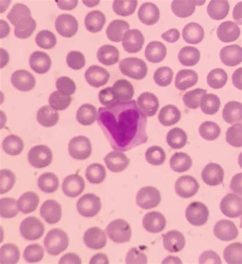 Image result for Monocyte Under Microscope