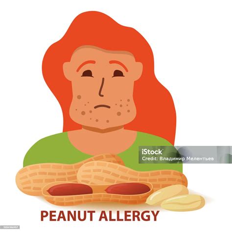Nut Allergy Symptoms Problem Swollen Man Character Stock Illustration - Download Image Now - iStock