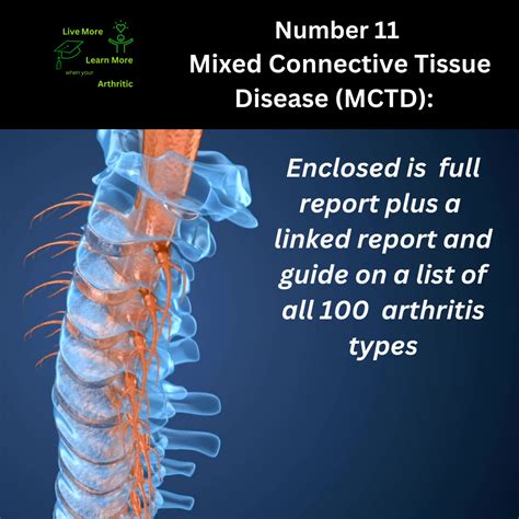 Mixed Connective Tissue Disease Rheumatoid Arthritis at Robert Sandoval blog