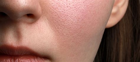 Serum for Textured Skin, Which Serum is best for Textured Skin – The ...