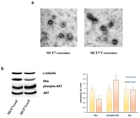Towards Unravelling the Role of ERα-Targeting miRNAs in the Exosome ...