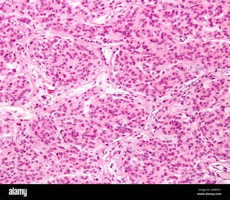 Human pineal gland lobulation, light micrograph Stock Photo - Alamy