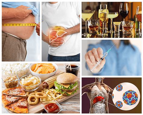 Best Ayurvedic Treatment for Liver - Liver treatment in Ayurveda