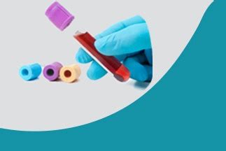 CHLORIDE, 24 HOUR URINE - TrueMedix