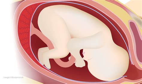 Image result for Fetus DNA Testing