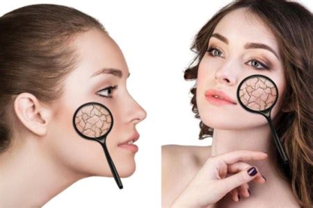 脸部脱皮怎么解决，几种方法改善脸部脱皮问题
