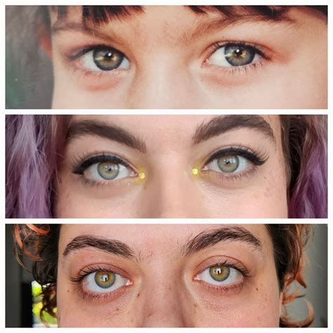 EDS eye droop? : r/ehlersdanlos