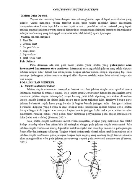 Image result for Continuous Suture Patterns