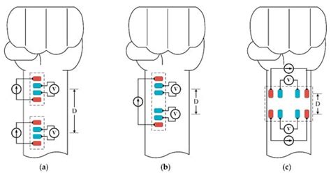 An Accurate Bioimpedance Measurement System for Blood Pressure Monitoring