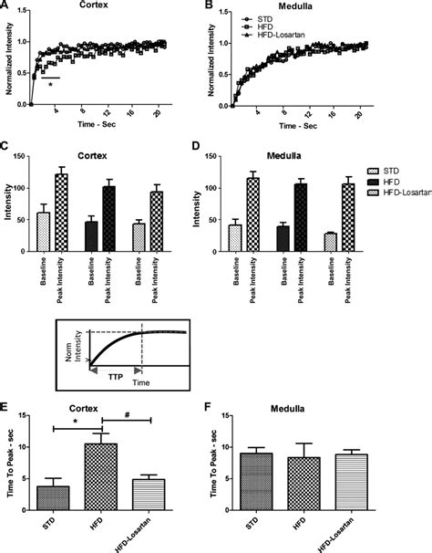 Image result for Time Intensity Compusense