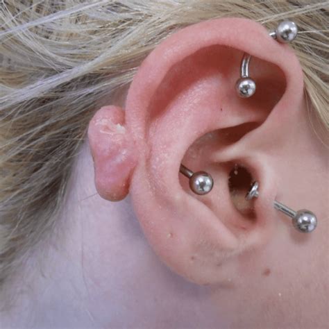 Keloid Industrial Piercing