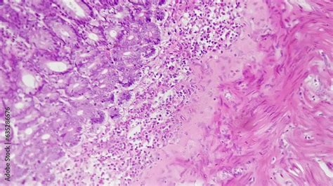 Image result for Jejunum Microscope