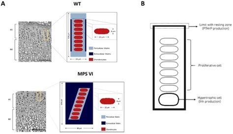 Diagnostics | Special Issue : Mucopolysaccharidoses: Diagnosis ...