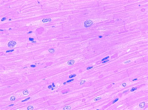 Image result for Cardiac Muscle Tissue Cells