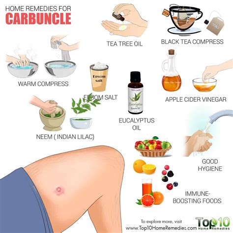 Image result for Removing Carbuncle