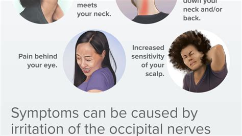 Occipital Neuralgia: What It Is and How to Fix It Video | Spine-health