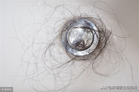 女人脱发是什么原因引起的？女人总脱发怎么办？ – 生发垂直网