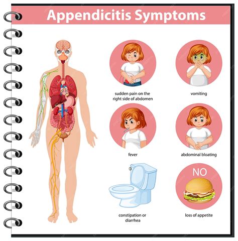 Image result for Appendicitis Assessment Signs