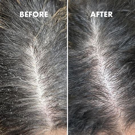 Scalp Restore Balancing Shampoo – 250ml – Fetch N Buy