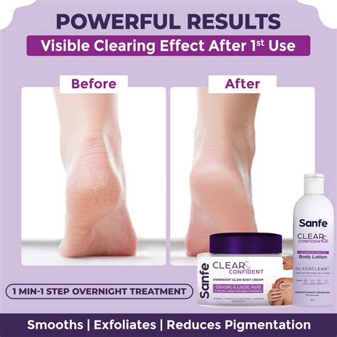 Complete Foot Care Regime – Sanfe