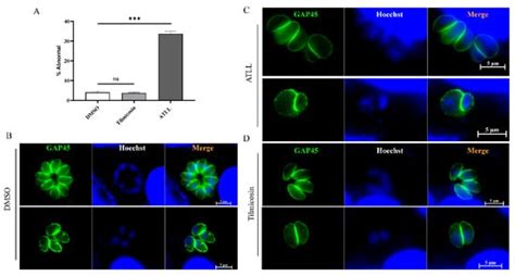 In Vitro and In Vivo Activities of Tilmicosin and ...