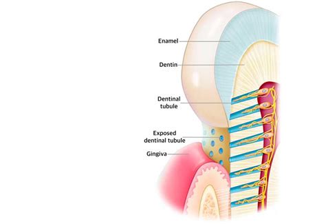 Tooth Sensitivity Treatment Navi Mumbai - Ivory Dental Clinic