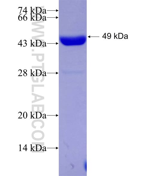 DCX Fusion Protein Ag29029 | Proteintech