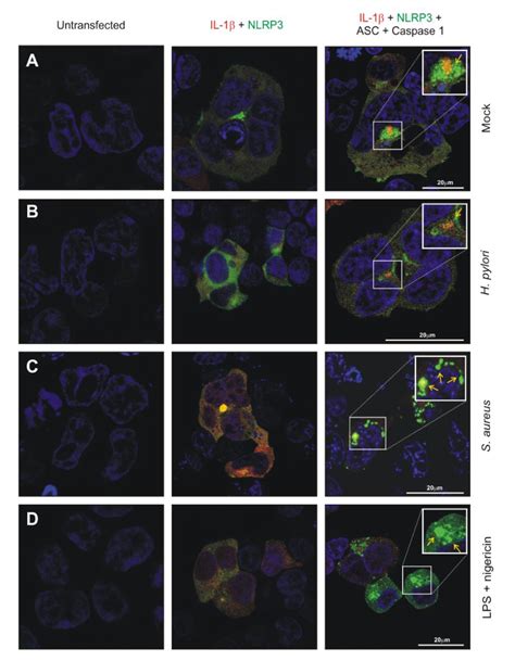 Helicobacter pylori Avoids the Critical Activation of NLRP3 ...