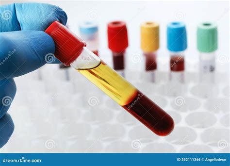 Image result for Test-Tube Sample