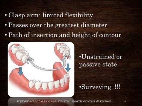 Image result for Clasp Method