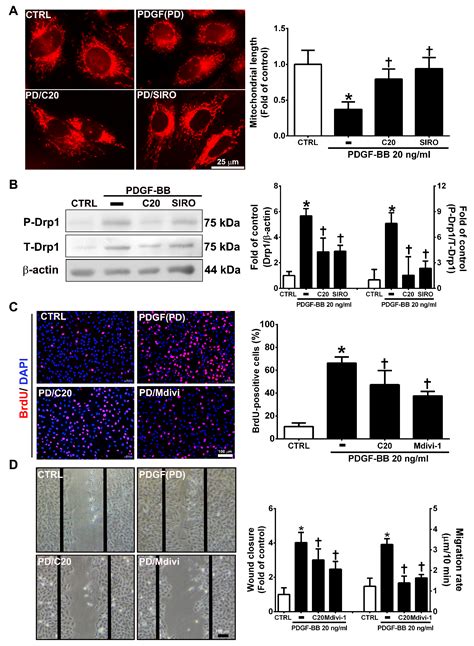 Corylin Inhibits Vascular Cell Inflammation, Proliferation and ...