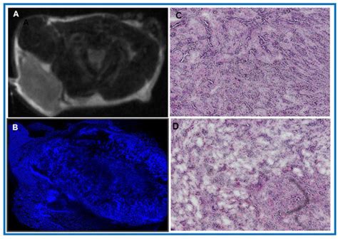 Tumor Microenvironment: Insights from Multiparametric MRI in Pancreatic ...