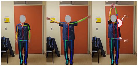 Automated Assessment of Upper Extremity Function with the Modified ...
