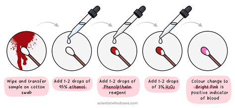 Preliminary Blood Tests in Forensic Investigations — Scientist who draws